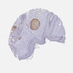 Tissue expression of IDH1 - Staining in skin - The Human Protein Atlas