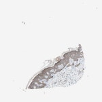 Tissue expression of HMGCR - Staining in skin - The Human Protein Atlas