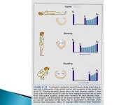 This is a technique of altering circulatory dynamics by means of a variety of physiological and pharmacological maneuvers and... 