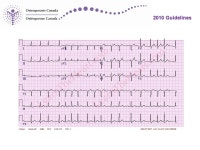 2010 Guidelines Papaioannou A, et al. CMAJ 2010 Oct 12. [Epub ahead of print] Clinical Practice Guidelines for the Diagnosis and... 