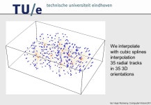 Ter Haar Romeny, Computer Vision 2014 Prof. Bart M. ter Haar Romeny, PhD Biomedical Image Analysis & Interpretation TU/e... 