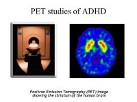 Evaluation of the Dopamine Hypothesis of ADHD with PET Brain Imaging James M. Swanson, Ph.D. Professor of Pediatrics, UC Irvine... 