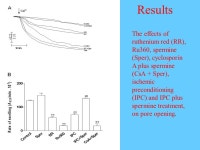 Involvement of the Mitochondrial Calcium Uniporter in Cardioprotection by Ischemic Preconditioning. -  ppt download