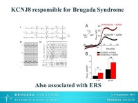 Overlapping genetic syndromes Ramon Brugada Director, Centre de Genètica Cardiovascular IDIBGI Cardiologist, Hospital Josep... 