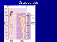 Chapter 9 Water and Minerals. Water 50%-70% of body weight 50... water Muscle contains 73% water –Fat contains ~20% -  ppt download