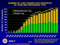 Advances in Lung Transplantation: A Patient Guide David J. Lederer, M.D., M.S. Assistant Professor of Medicine New York... 