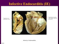 One night at the Foot… 64yo male found down at home… -HR 111 -BP 109/67 -RR 12 -Temp O2 88% -Glucose ppt download