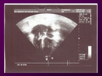 One night at the Foot… 64yo male found down at home… -HR 111 -BP 109/67 -RR 12 -Temp O2 88% -Glucose ppt download