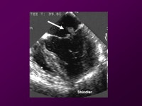 One night at the Foot… 64yo male found down at home… -HR 111 -BP 109/67 -RR 12 -Temp O2 88% -Glucose ppt download