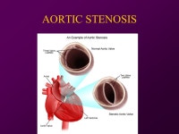 One night at the Foot… 64yo male found down at home… -HR 111 -BP 109/67 -RR 12 -Temp O2 88% -Glucose ppt download