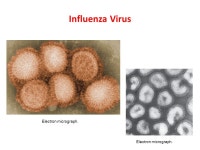 Viral Infections of the Respiratory System.  Common cold (rhinitis)  Pharyngitis  Tonsilitis  Sinusitis & otitis media  Croup... 