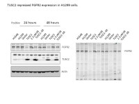 H1299 Vector H1648 TUSC2 TUSC2 -ER 2.3 uM ER H1299 Vector TUSC2... 3 uM ER H1299 Vector H1648 TUSC2 TUSC2 -ER 2.3 uM ER H1299... 