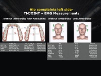 Under Armour Performance Mouthwear Neuromuscular Balance through ArmourBite. -  ppt download
