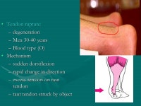 Sports Injuries Primary Care on-field دکتر باقری مقدم متخصص پزشکی ورزشی. -  ppt download