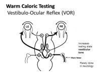 Anoxic Auguring: Neurological Prognostication After Cardiopulmonary Resuscitation Where do we stand in 2011? Robert Altman PGY 4... 