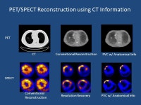 1 Imaging Physics Chi Liu CT PET SPECT -Image Reconstruction Algorithms -Respiratory and Cardiac Motion Correction -Quantitative... 