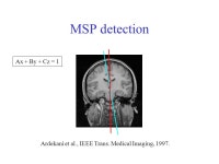 Model-based Automatic AC/PC Detection on Three-dimensional MRI Scans Babak A. Ardekani, Ph.D., Alvin H. Bachman, Ph.D., Ali... 