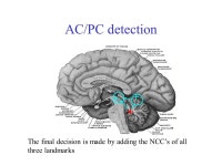 Model-based Automatic AC/PC Detection on Three-dimensional MRI Scans Babak A. Ardekani, Ph.D., Alvin H. Bachman, Ph.D., Ali... 