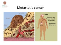 Cancer 101 Spring Family Cancer Retreat 4/18/15 Amish Shah, M.D. New Mexico Cancer Center. -  ppt download