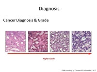 Cancer 101 Spring Family Cancer Retreat 4/18/15 Amish Shah, M.D. New Mexico Cancer Center. -  ppt download