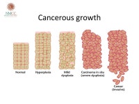 Cancer 101 Spring Family Cancer Retreat 4/18/15 Amish Shah, M.D. New Mexico Cancer Center. -  ppt download