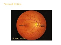 Chapter 8 Part A Vision Essentials of Human Anatomy & Physiology -  ppt download