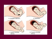 Intrapartum Labor and Delivery. 5 factors to consider in planning your nursing care Passenger: the fetus Passageway: pelvis... 