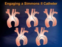 Carotid Angiography: Information Quality and Safety Michael J. Cowley, M.D., FSCAI. -  ppt download