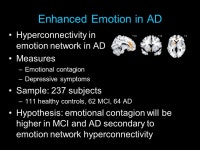 Effects of Brain Disease On Our Loved Ones and Our Relationships Virginia Sturm, PhD May 4, ppt download