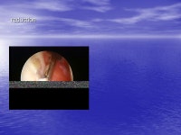 GIORGOS - GRIGORIS KARACHALIOS Orthopaedic Surgeon Director of Arthroscopic Surgery Dpt Director of Arthroscopic Surgery Dpt... 