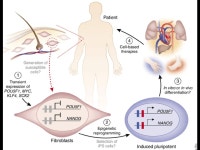 What do genes do? Chapter 17 - Protein Synthesis 96% 36% 7% 21% 15% -  ppt download