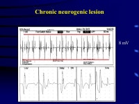 Neuromuscular Diseases Radim Mazanec, MD, Ph.D Department of Neurology. -  ppt download