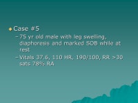 Chest X-ray Findings in Heart Failure -  ppt video online download