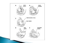  Voluntary regulation of the number of children produced and when they are conceived.  Coitus interrupts: withdrawal of the penis... 