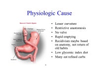 Sleeve En Y Does Changing the Name Change the Perception? Mitchell Roslin, MD FACS Chief of Bariatric Surgery Lenox Hill Hospital... 