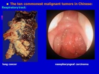 Chapter 5 Neoplasia Su Min ( 苏敏）. CPC-CASE ： (N0A6-1) A 37 year old man found a dark brown lesion on the skin of his face... 