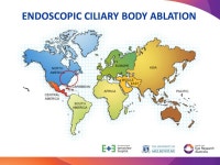 A TOUR OF THE WORLD OF GLAUCOMA SURGERY Dr. Jennifer Fan Gaskin Glaucoma Specialist. -  ppt download