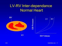 5/98MedSlides.com1 Pulmonary (Arterial) Hypertension  -  ppt download