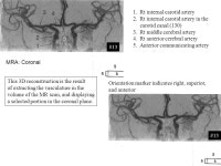 Arteriograms and Lower Limb Venograms Numbers next to items refer to plates in Netter’s Atlas of Atlas of Human Anatomy Numbers... 