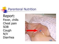 MNA M osby ’ s Long Term Care Assistant Chapter 25 Nutritional Support and IV Therapy. -  ppt download