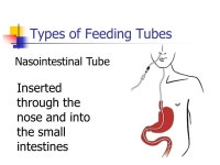 MNA M osby ’ s Long Term Care Assistant Chapter 25 Nutritional Support and IV Therapy. -  ppt download