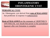 DISORDERS OF MAXILLA AND MANDIBLE(CYSTS AND TUMOURS) DR.SHAHZADI TAYYABA HASHMI -  ppt download