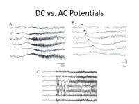 DC Potential and the Brain Ali Gorji Epilepsy Research Center Münster University. -  ppt download