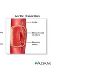 Valvular Heart Disease/Myopathy/Aneurysm By Nancy Jenkins. -  ppt download