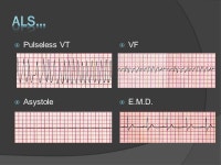 Dr.Dhananjaya Bulathwatta. Importance Importance CPR TIME LINE  0-4 mins. brain damage unlikely  4-6 mins. brain damage possible... 
