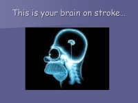 Secondary Prevention of Stroke (aka the Homer Talk) Roland Halil, BSc(Hon), BSc(Pharm), ACPR, PharmD Bruyere Academic Family... 