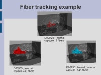 NA-MIC - Contrasting Tractography Method Conference Utah/UNC results Sylvain Gouttard Guido Gerig Casey Goodlett Santa Fe... 