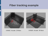 NA-MIC - Contrasting Tractography Method Conference Utah/UNC results Sylvain Gouttard Guido Gerig Casey Goodlett Santa Fe... 