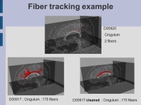 NA-MIC - Contrasting Tractography Method Conference Utah/UNC results Sylvain Gouttard Guido Gerig Casey Goodlett Santa Fe... 
