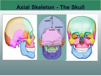 Copyright © 2005, Elsevier, Inc. All rights reserved. Slide 0 0 Copyright © 2005, Elsevier, Inc. All rights reserved. Slide 0... 